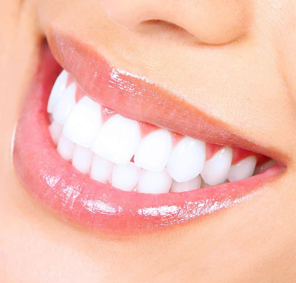 Why Get a Professional Teeth Whitening